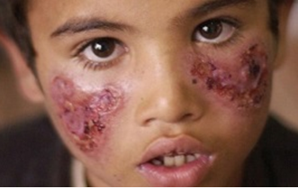 IS phát tán bọ ăn thịt người khắp Syria
