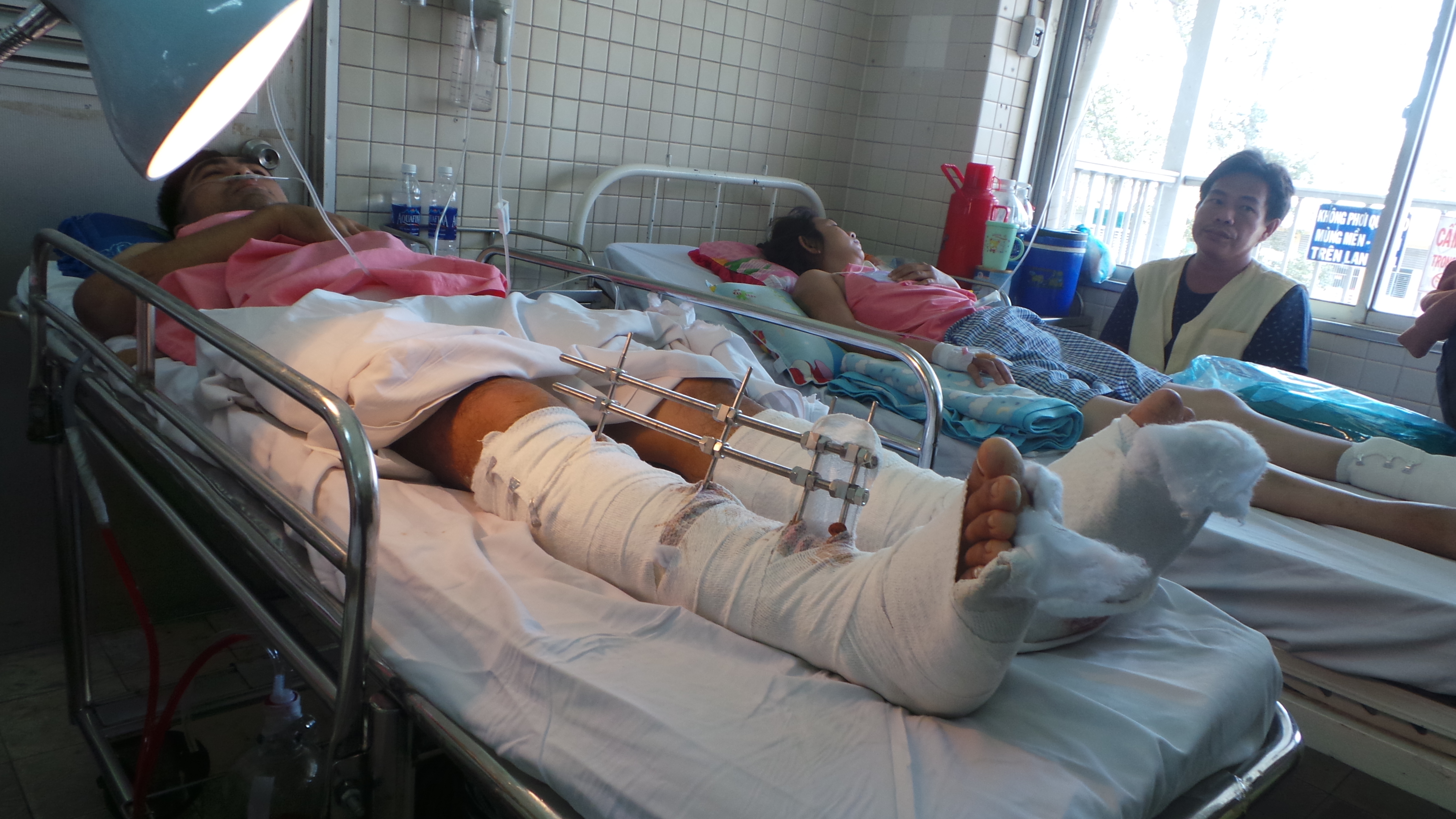 Anh l&aacute;i t&agrave;u với đ&ocirc;i ch&acirc;n g&atilde;y sau vụ tai nạn hy hữu