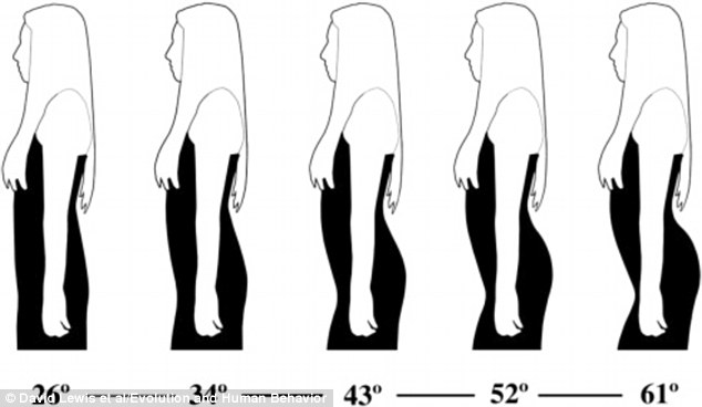 Đ&agrave;n &ocirc;ng th&iacute;ch phụ nữ c&oacute; phần cột sống dưới cong 45,5 độ. Ảnh: Daily Mail