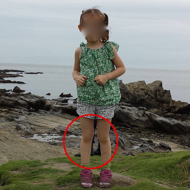 Đ&ocirc;i gi&agrave;y đen b&iacute; ẩn v&agrave; một mảnh &aacute;o m&agrave;u xanh ph&iacute;a sau ch&acirc;n v&agrave; lưng con g&aacute;i &ocirc;ng Springall (khoanh đỏ). Ảnh: Daily Mail