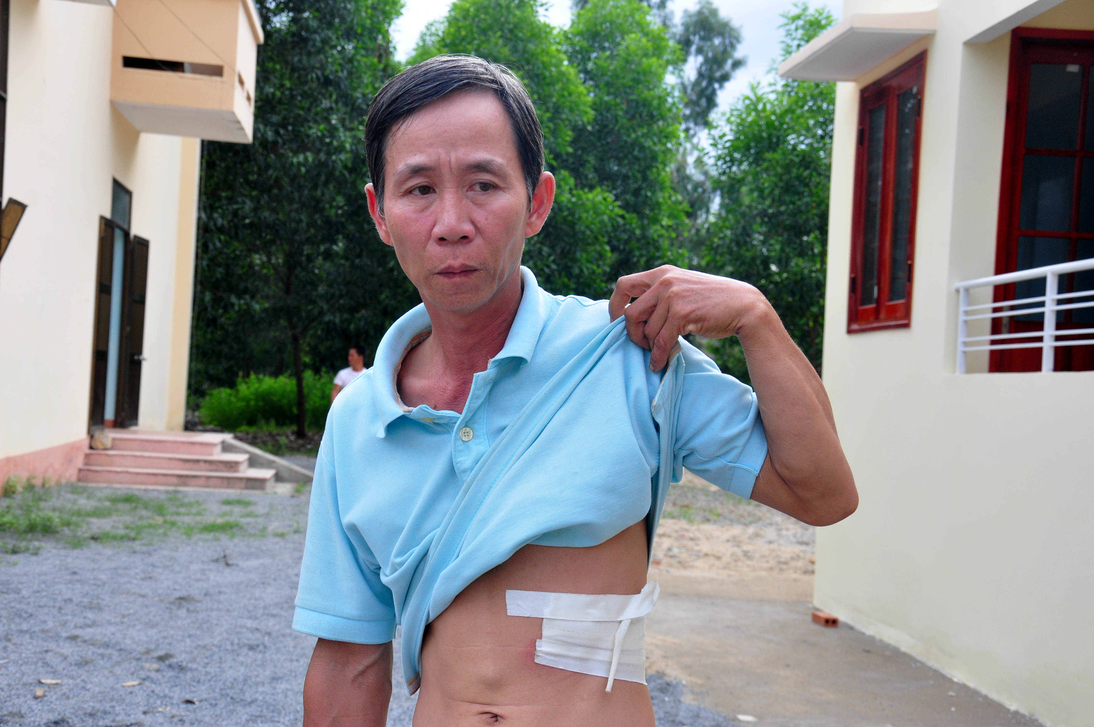 Ngư d&acirc;n V&otilde; Văn Đạo bị g&atilde;y 3 xương sườn do l&uacute;c t&agrave;u gặp nạn va v&agrave;o. Ảnh: Tử Trực