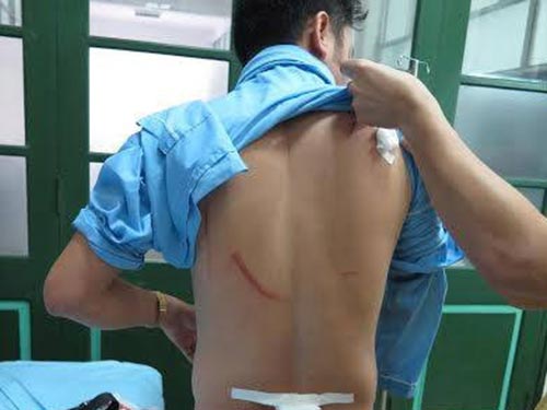 Khẩn trương điều tra vụ nhà báo bị hành hung