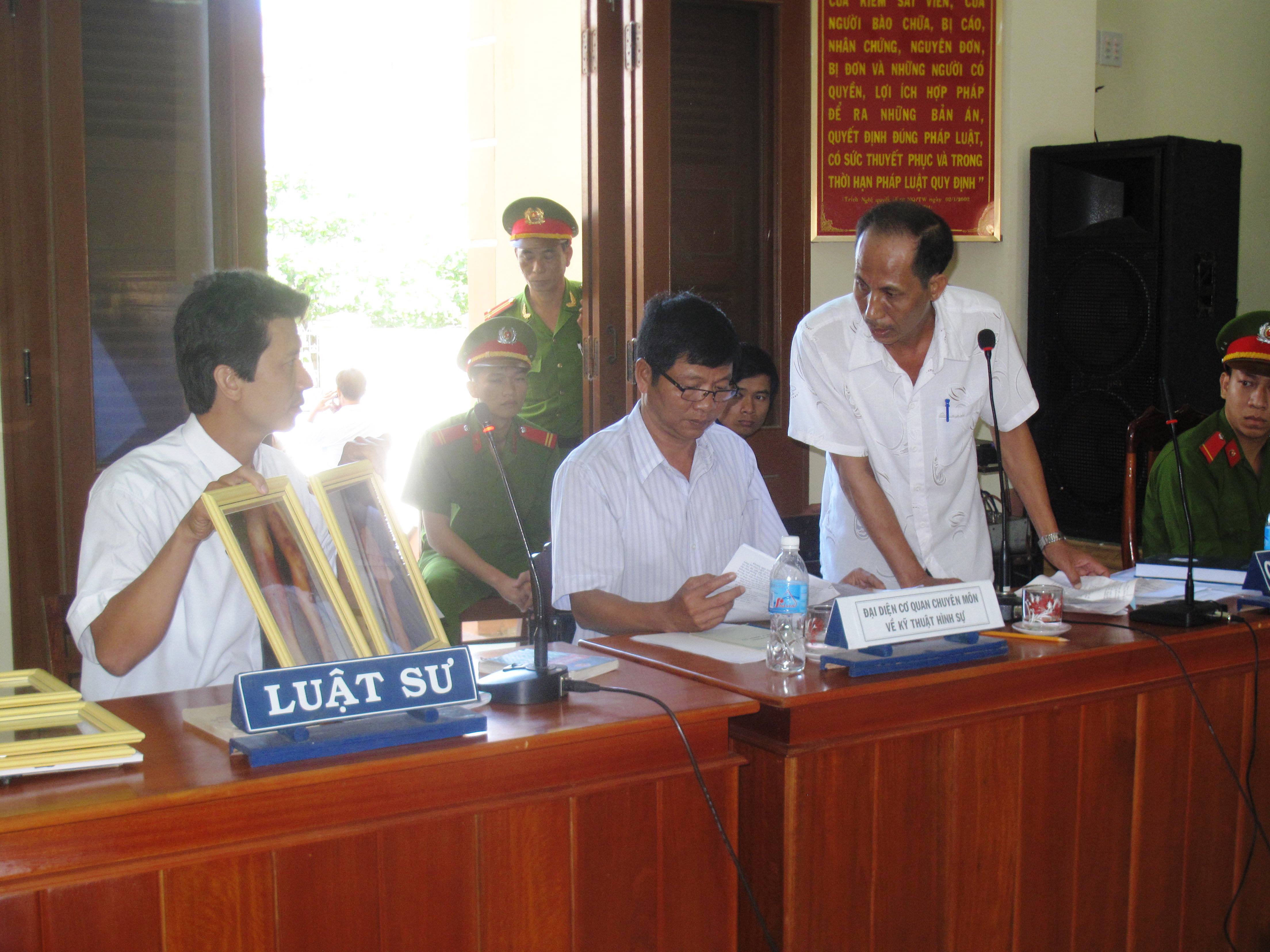 LS V&otilde; An Đ&ocirc;n tr&igrave;nh b&agrave;y c&aacute;c bức ảnh với những vết thương nghi do ch&aacute;y