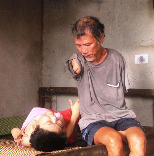 &ldquo;Chim c&aacute;nh cụt&rdquo; chăm s&oacute;c người con g&aacute;i tật nguyền