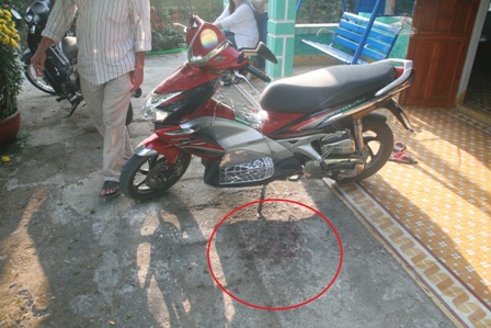 Bắt kẻ bắn xuyên má người yêu sau gần 1 năm lẩn trốn