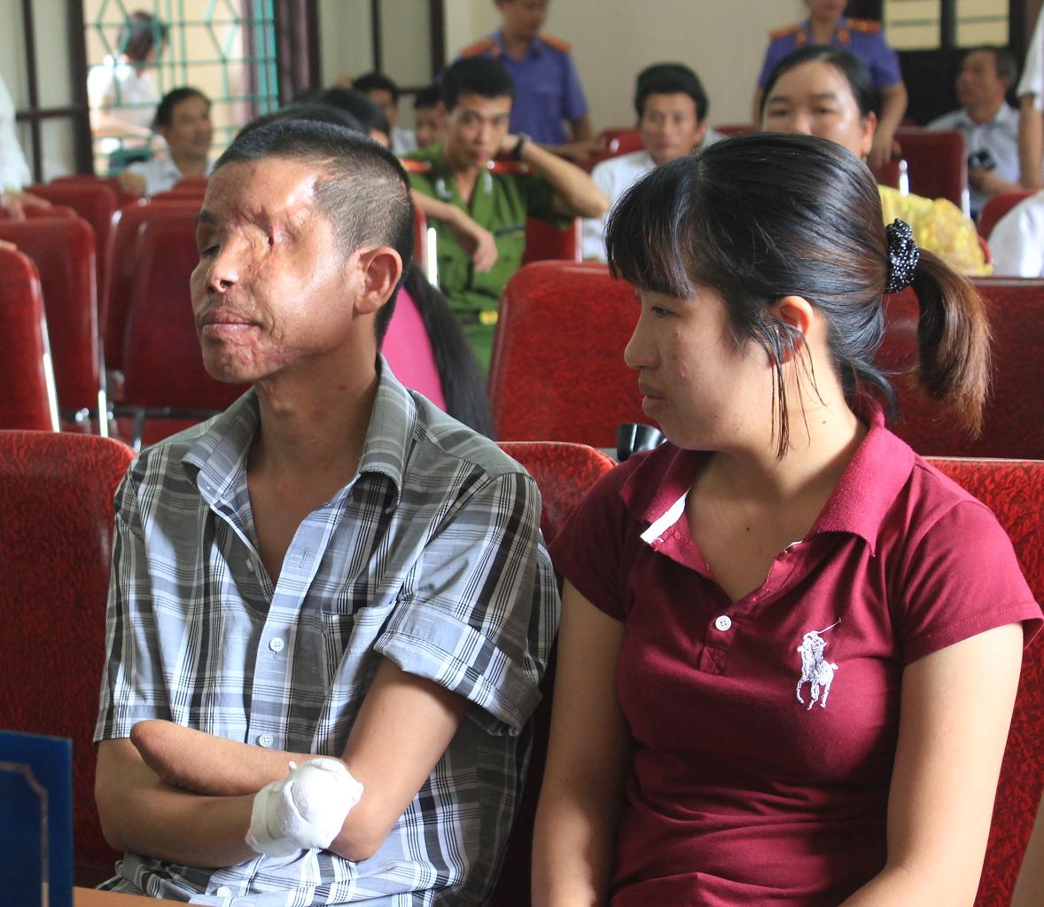 Khu&ocirc;n mặt biến dạng của nạn nh&acirc;n Hảo tại phi&ecirc;n t&ograve;a.