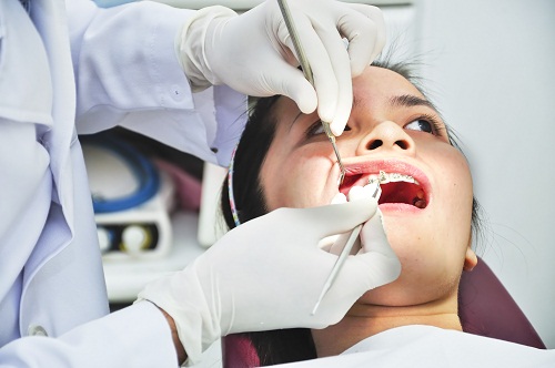 Để tránh tình trạng nhổ răng "oan"