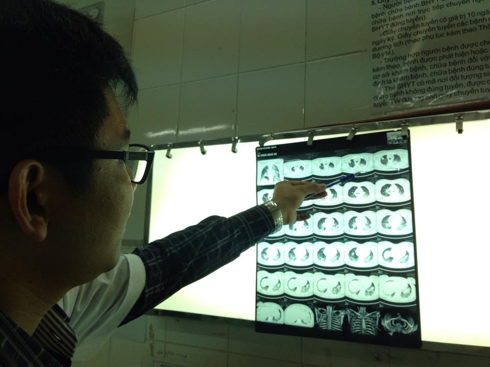 Phim chụp X-quang của bệnh nh&acirc;n N.T.D