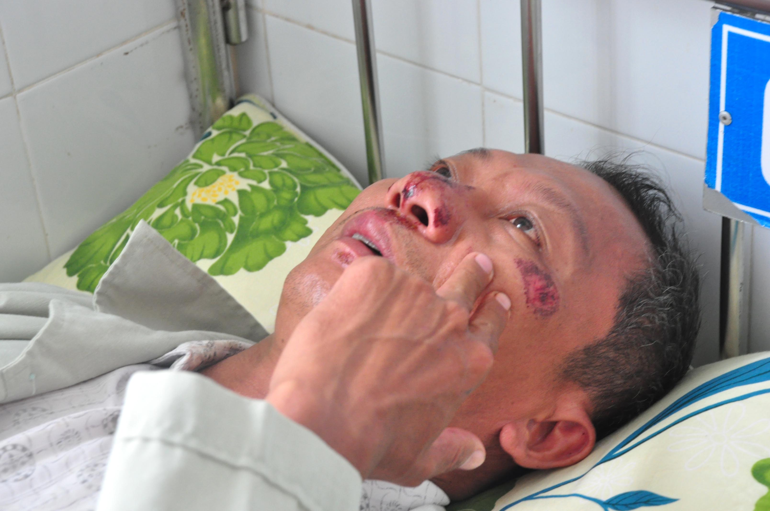 &Ocirc;ng Trương Quang Ch&acirc;u nhập viện v&igrave; x&ocirc; x&aacute;t với ph&oacute; chủ tịch x&atilde; Tịnh Kh&ecirc;. Ảnh: T.Trực