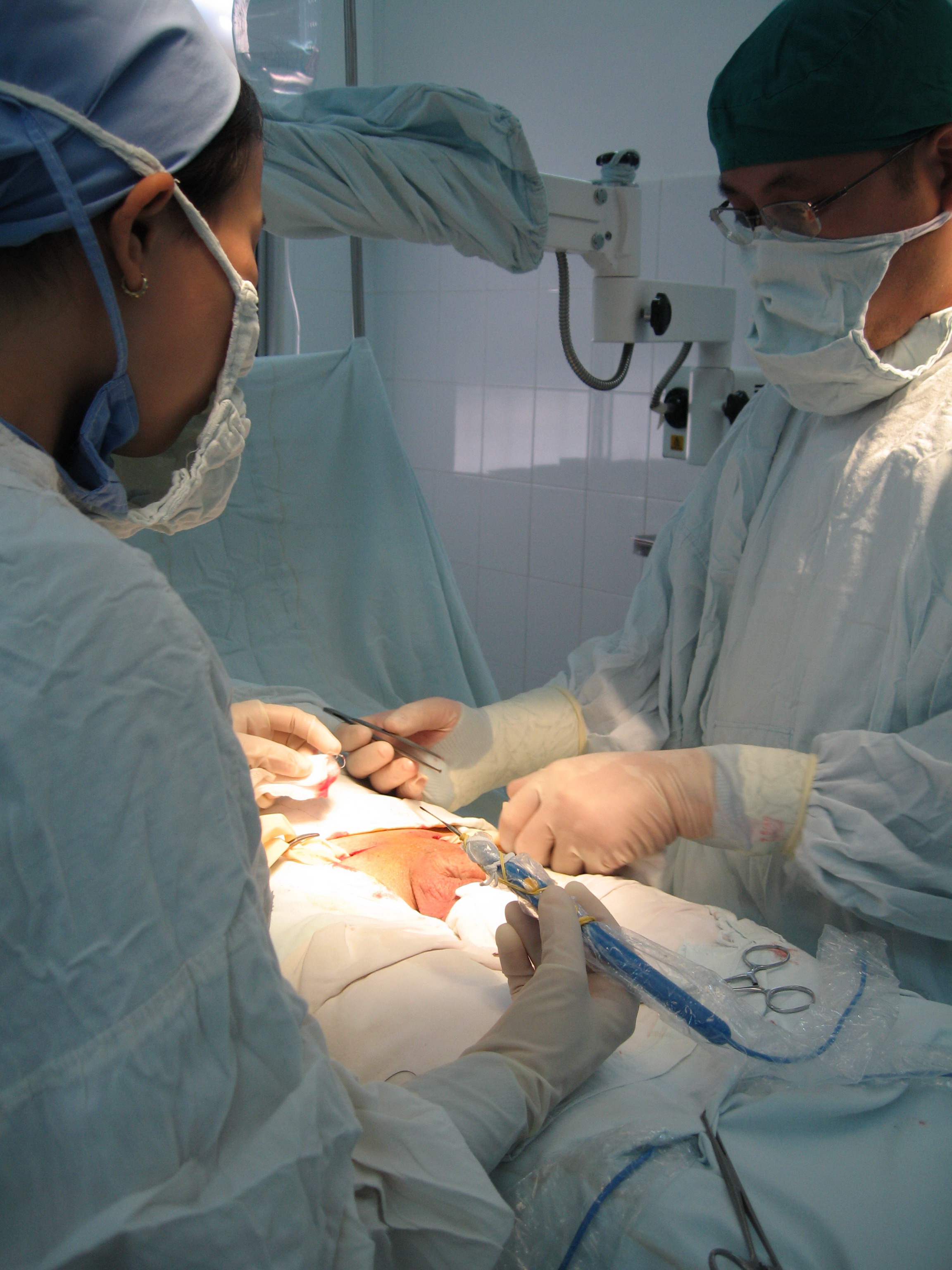 Một ca phẫu thuật dương vật tại BV Bình Dân TP HCM