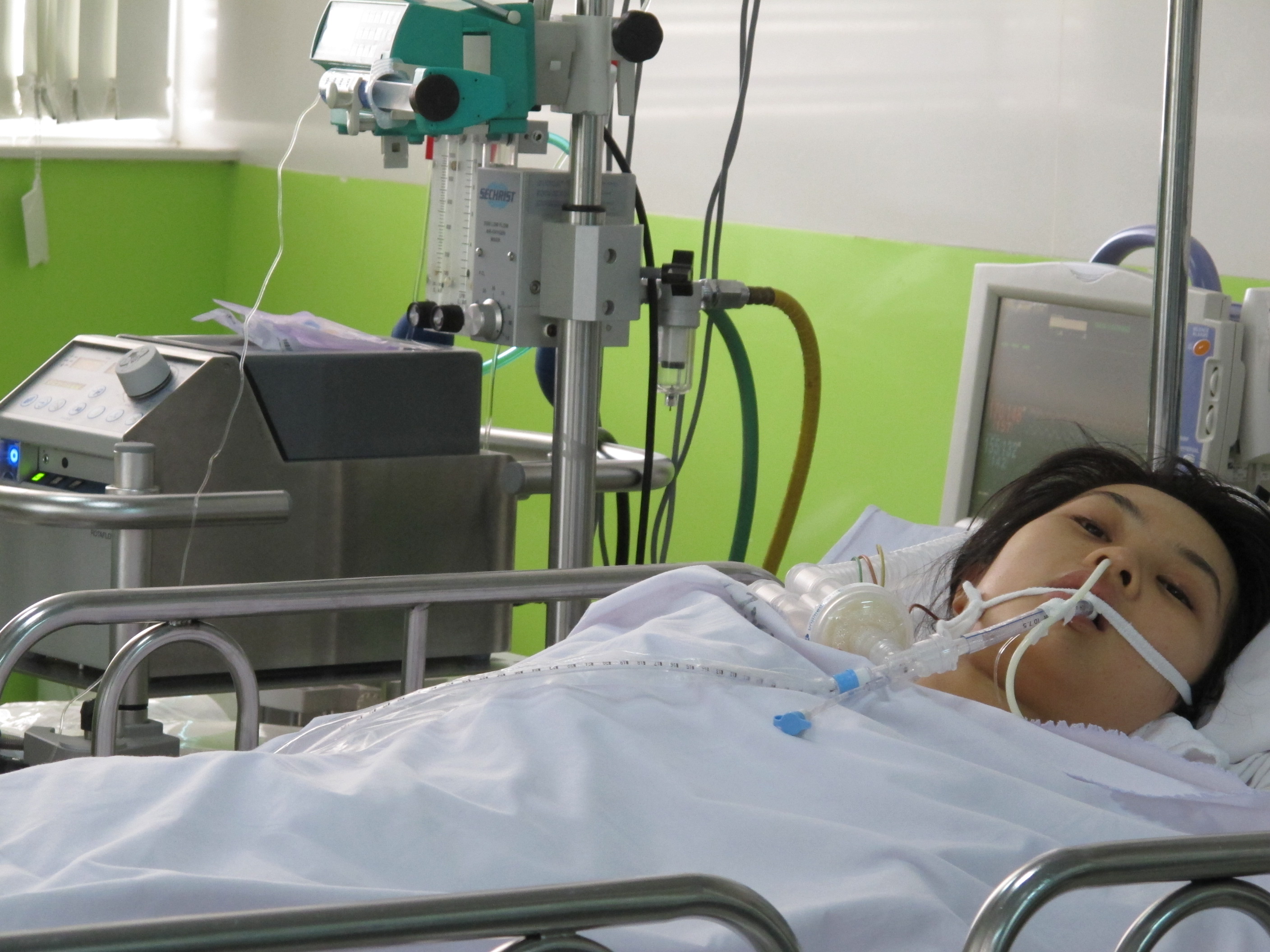 M&ocirc;̣t nữ b&ecirc;̣nh nh&acirc;n đang được đi&ecirc;̀u trị bằng phương pháp ECMO
