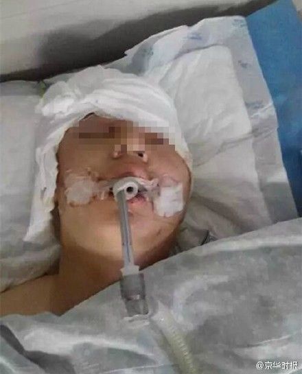受害者(图片来自京华时报微博)