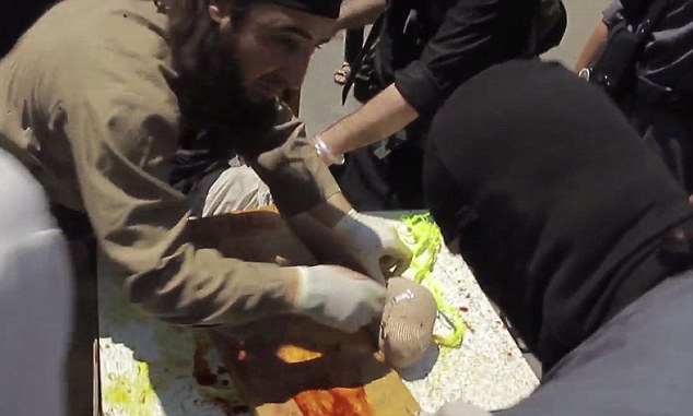 Brutal: The suspected thief does not seem to have been anaesthetised, but his foot is quickly bandaged (pictured)