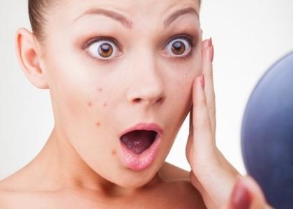 Làm gì khi bị dị ứng mỹ phẩm?