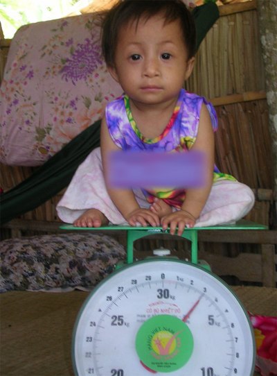 9 năm về trước, Tr&uacute;c Ly chỉ c&acirc;n nặng đ&uacute;ng 3kg, d&ugrave; đ&atilde; 5 tuổi. Ảnh: C&ocirc;ng Tuấn