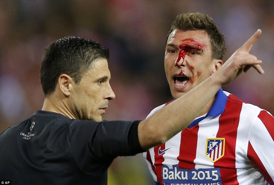 M&aacute;u đổ tr&ecirc;n mặt Mandzukic sau pha tranh chấp với Ramos