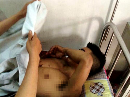 Khởi tố kẻ ôm bạn gái tuổi teen rồi nổ mìn tự sát
