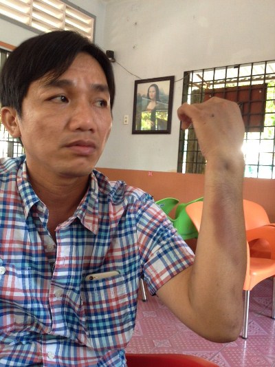 Con trai giám đốc công an Cà Mau: "Tôi bị đánh hội đồng"