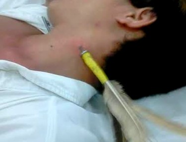 Chơi phi tiêu, phóng nhầm vào cổ nhân viên hội chợ