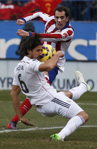 Godin phải băng mũi sau pha va chạm với Khedira