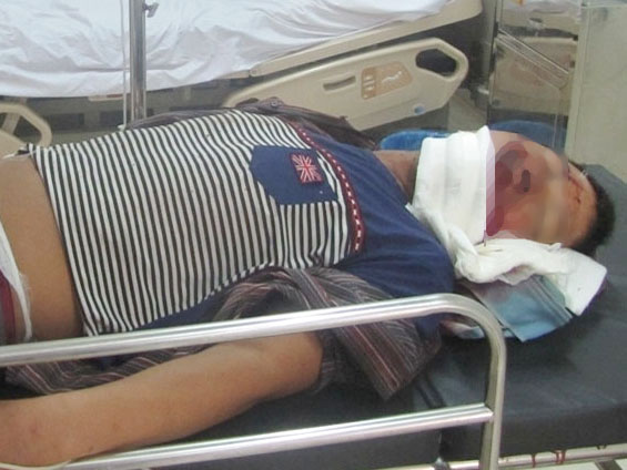 Một c&ocirc;ng nh&acirc;n bị thương nặng trong vụ sập gi&agrave;n gi&aacute;o tại dự &aacute;n Formosa ng&agrave;y 27-7-2014 được cấp cứu tại b&ecirc;nh viện. Ảnh: Dũng Nguy&ecirc;n