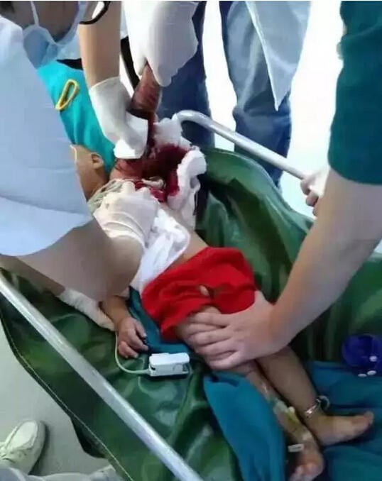 ...với cánh tay đẫm máu. Ảnh: QQ