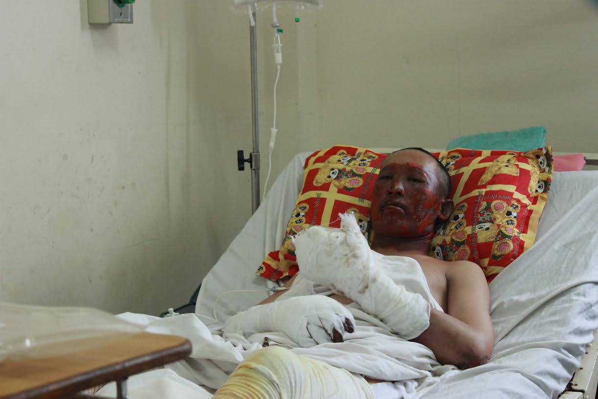 Anh Hoàng cho biết vừa cho thép vào lò luyện thì bị nổ
