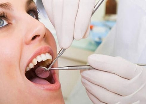 Thắc mắc về việc cạo vôi răng khi viêm nướu
