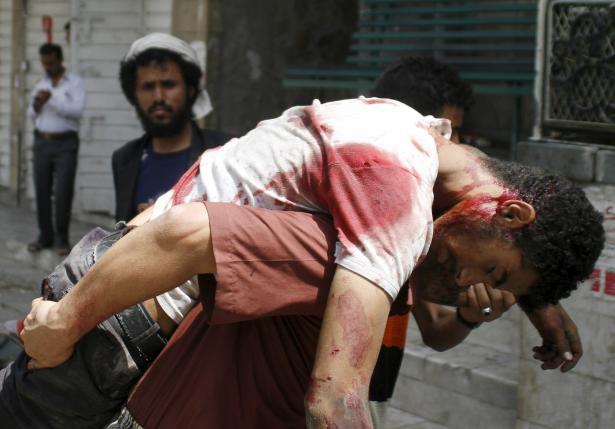 Một người bị thương trong cuộc tấn c&ocirc;ng giữa d&acirc;n qu&acirc;n địa phương v&agrave; phiến qu&acirc;n Houthi h&ocirc;m 26-4. Ảnh: Reuters