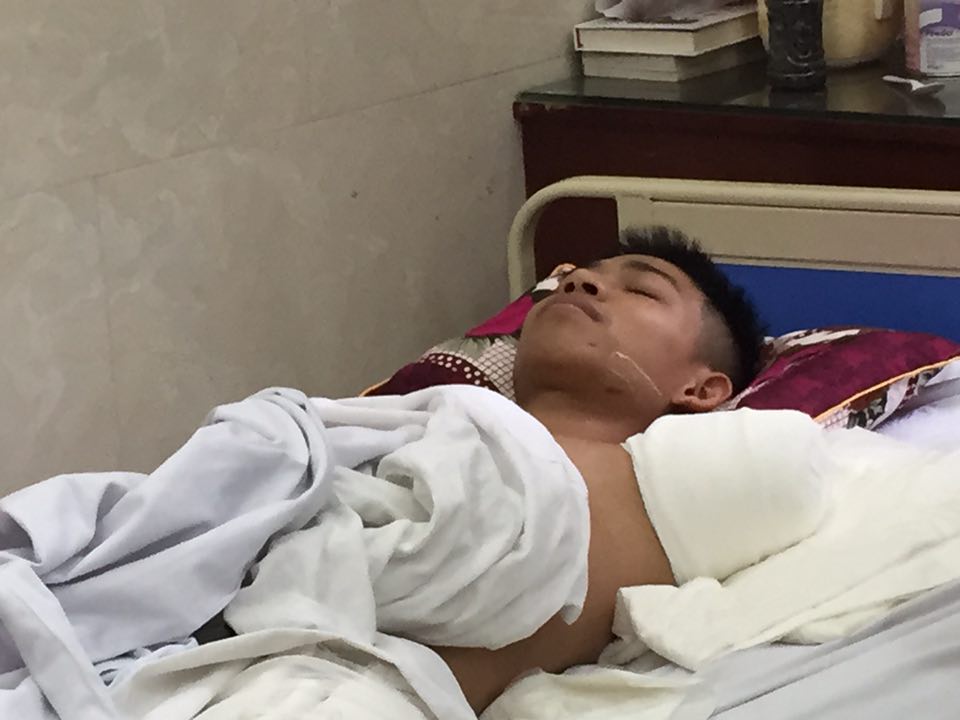 "Chàng trai cụt tay vì cứu bạn" lên tiếng bất ngờ
