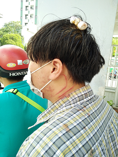 Trong l&uacute;c x&ocirc; x&aacute;t, một sinh vi&ecirc;n bị thương