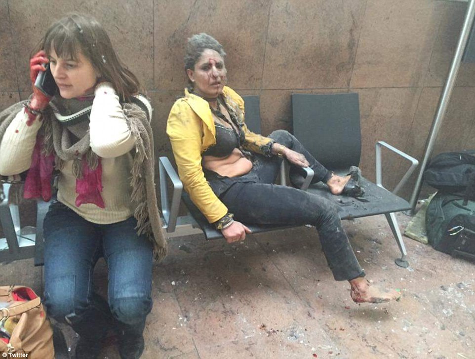 Injured passengers are covered in blood and dust after the explosions in the terminal building