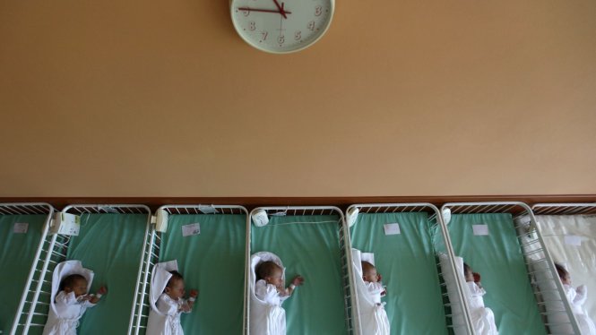 Ngoài Zika, virus CMV cũng gây teo não ở trẻ sơ sinh