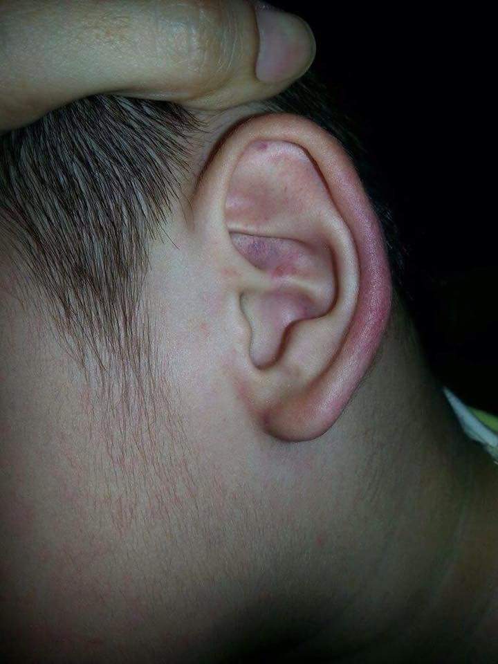 Trẻ bị cô nhéo bầm tai, đánh và quăng ra sàn