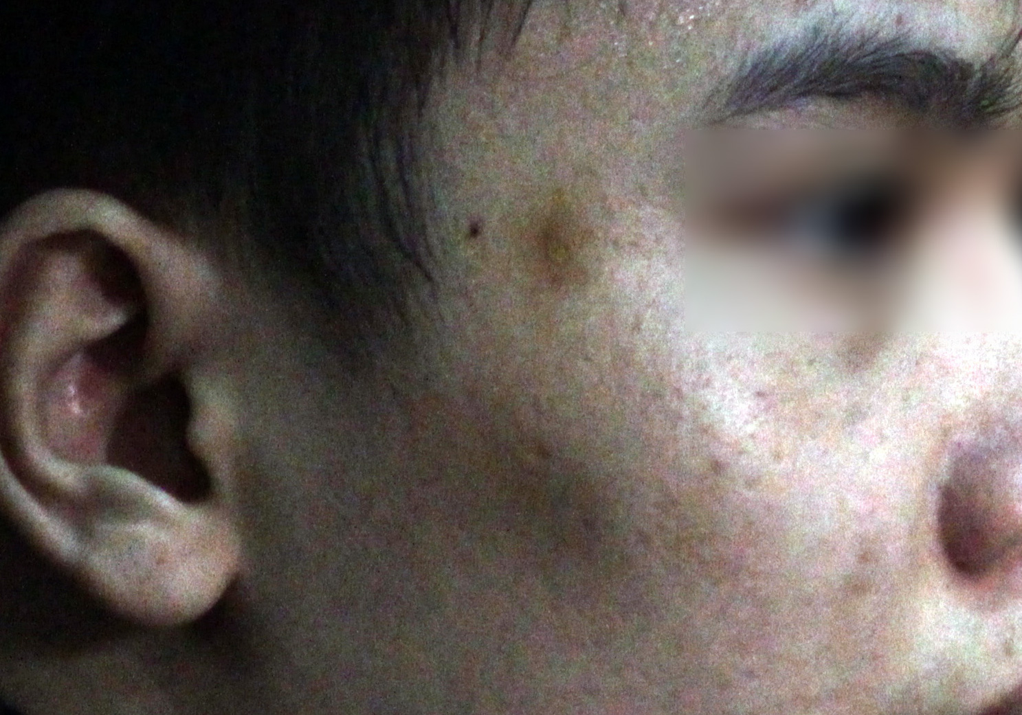 Nam thiếu niên xâm hại ba chị em ruột