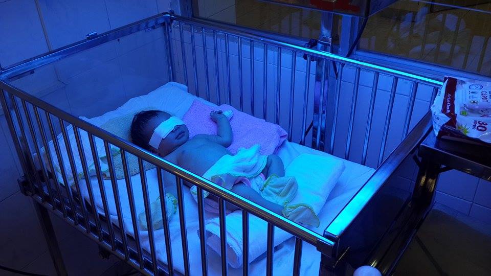 Mẹ cắn đứt ngón tay con 2 ngày tuổi
