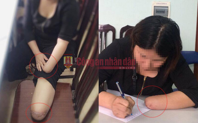 Người phụ nữ thuê chặt tay, chân với giá 50 triệu đồng