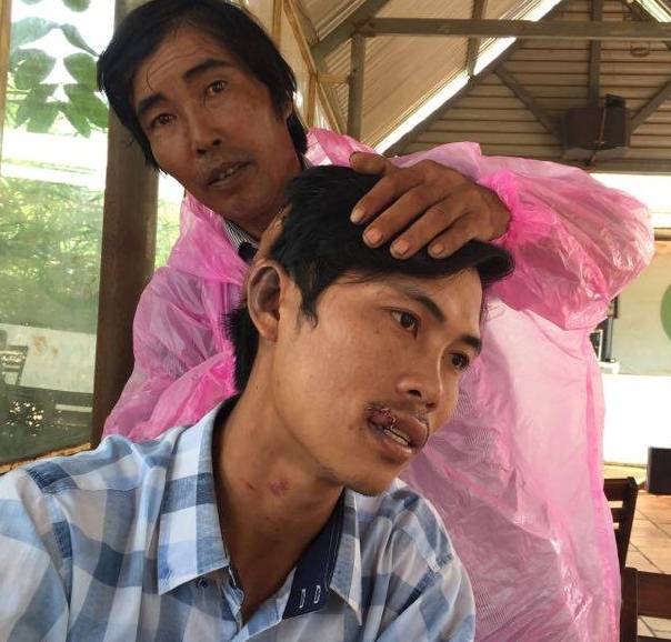 
Nhiều vết thương ở miệng, tai, cổ của &ocirc;ng Sang

