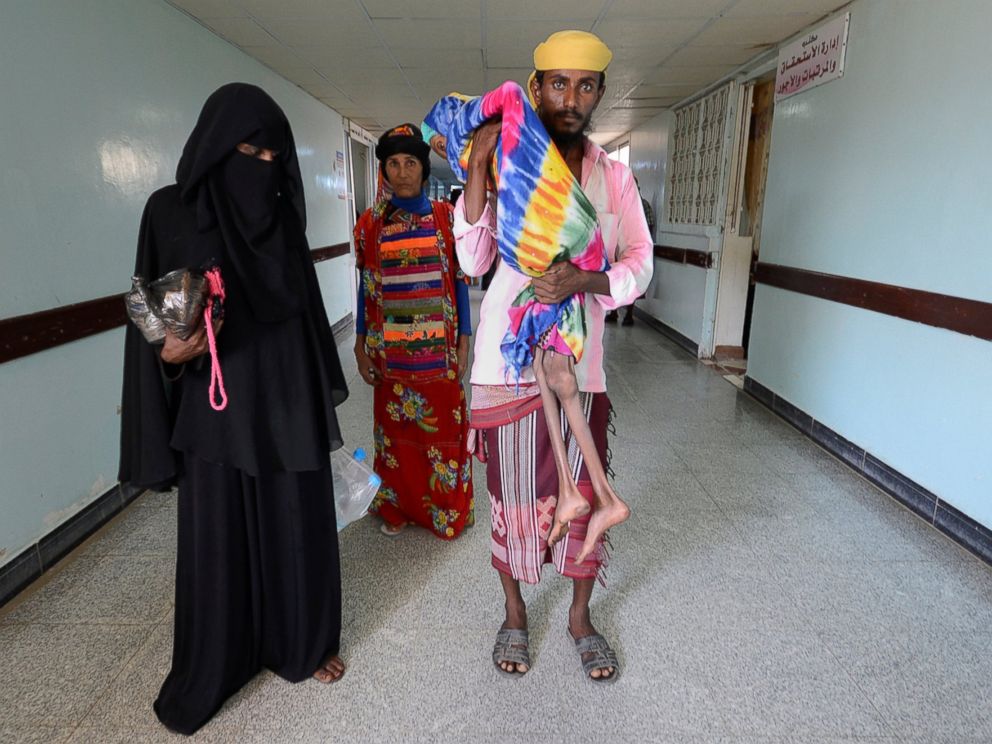 Hình ảnh tàn khốc trong cuộc chiến ở Yemen