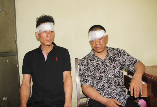 Trộm chó mang theo kiếm búa, bị dân đánh trọng thương