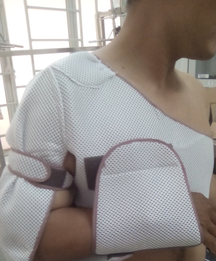 Hiệp sĩ L.N.P (32 tuổi) bị thương sau khi bị nhóm đối tượng tấn công