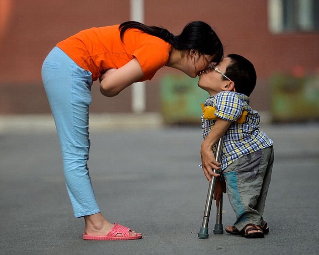Cảm động chuyện tình giữa chàng trai tí hon và cô gái tật nguyền