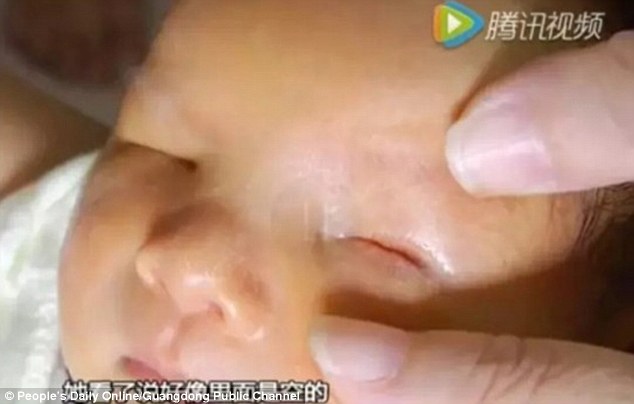 "Em bé không mắt” ở Trung Quốc