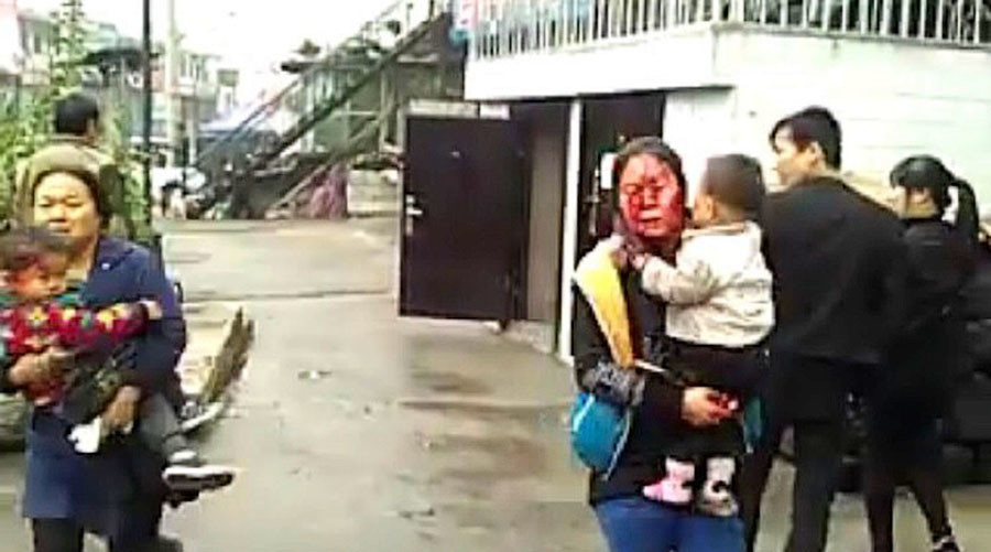 Một số người dân bị thương. Ảnh: WEIBO