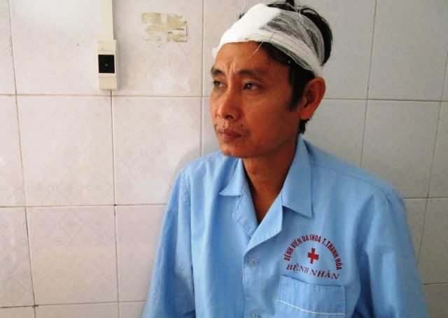 1 công nhân bị 2 thanh niên đeo khẩu trang đánh nhập viện