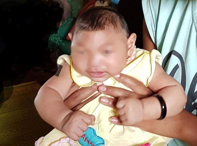 Việt Nam phát hiện trẻ nghi mắc chứng đầu nhỏ do virus Zika
