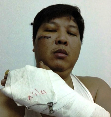 Vụ chủ tiệm vàng cầu cứu Bí thư Thăng: Bắt giam nghi can