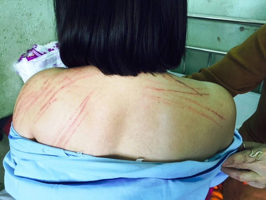 Vụ luật sư bị đánh tại tòa: Vắng mặt phía bị đơn, tòa vẫn tuyên án