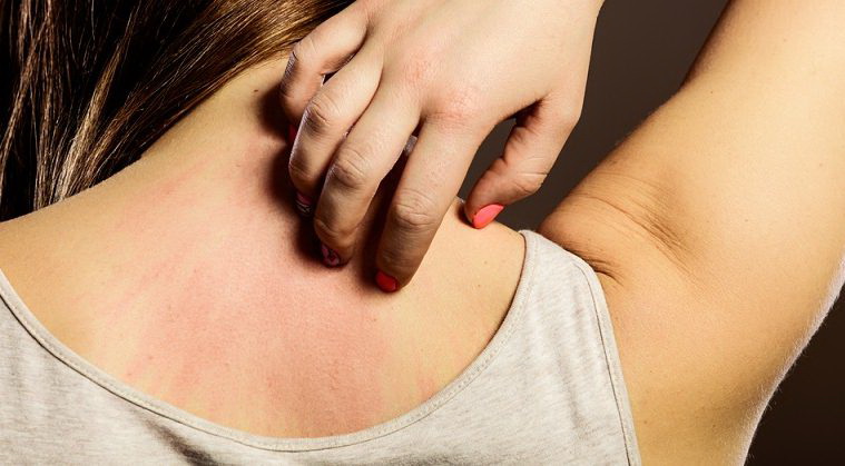 Thận trọng trước dấu hiệu cảnh báo sớm ung thư