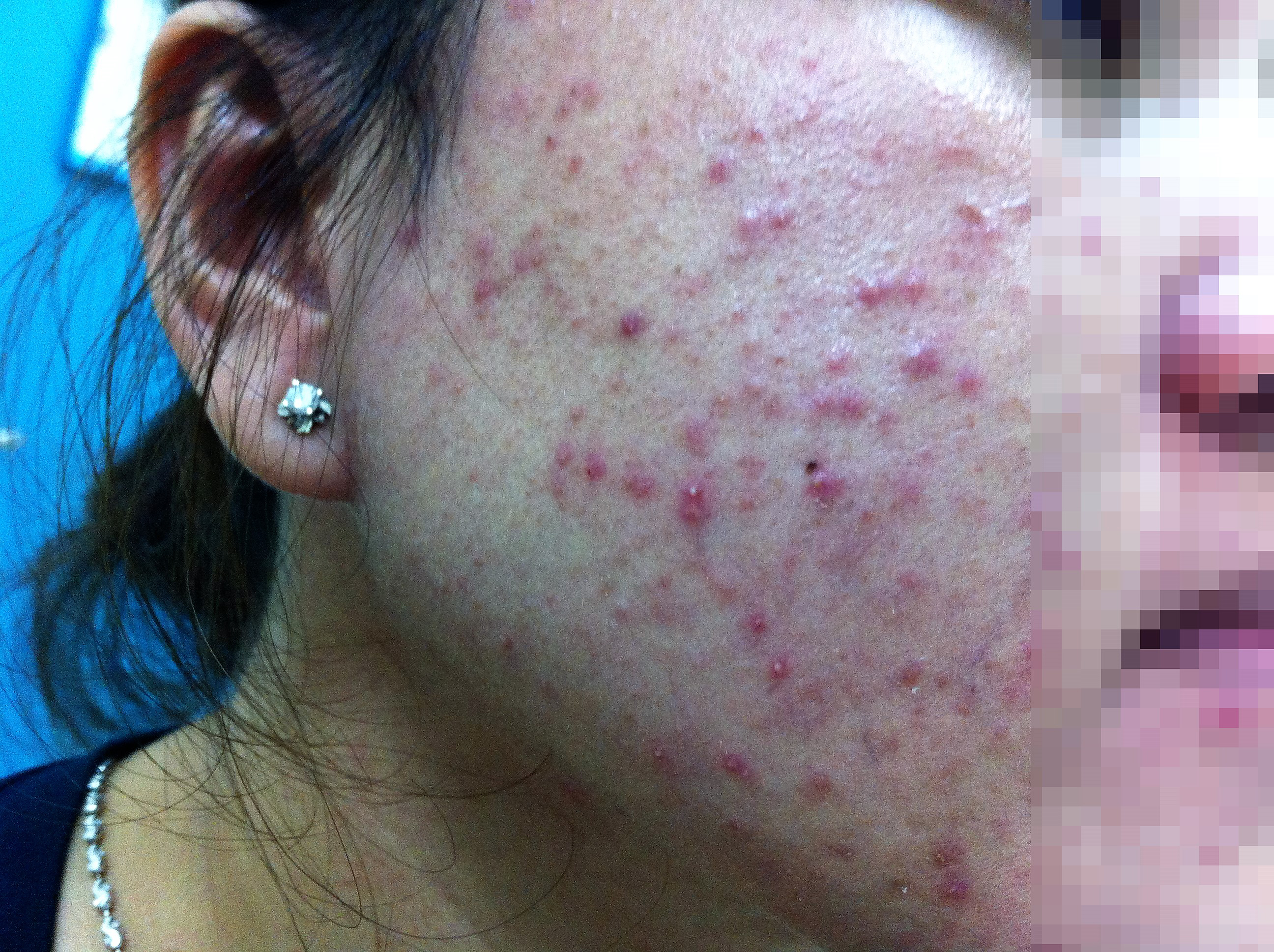 Mỹ phẩm dỏm tàn phá dung nhan